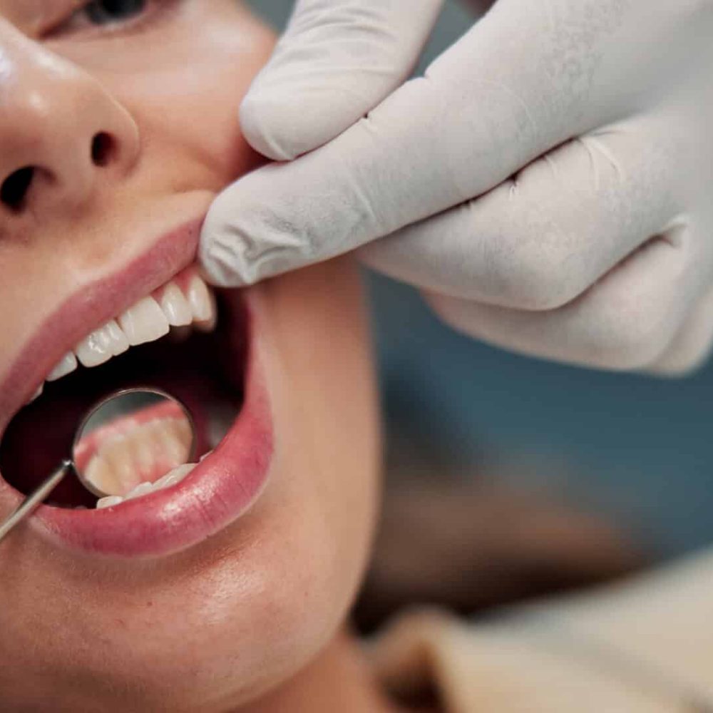 Hands, mirror and mouth with woman at dentist for appointment, inspection or medical checkup. Dental care, equipment and teeth of patient at orthodontist for cleaning, examination or oral hygiene